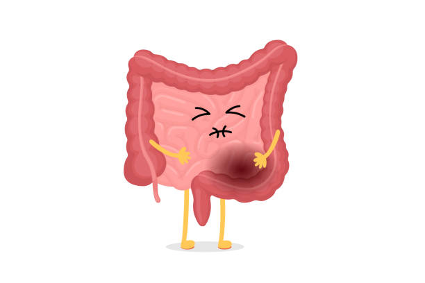 Bowel Issues
