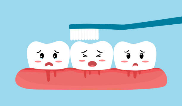 Gum Issues