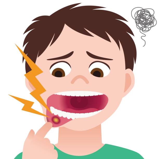 Ulcers